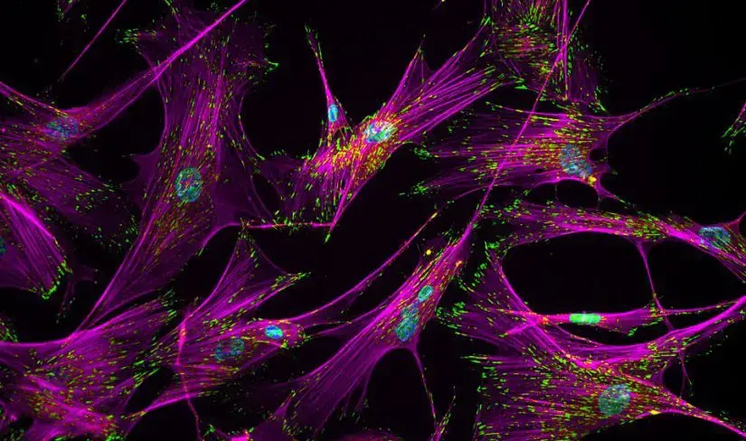 Stem cells