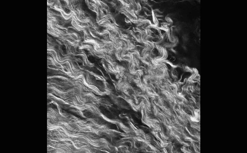 collagen fibers in cancerous tissue