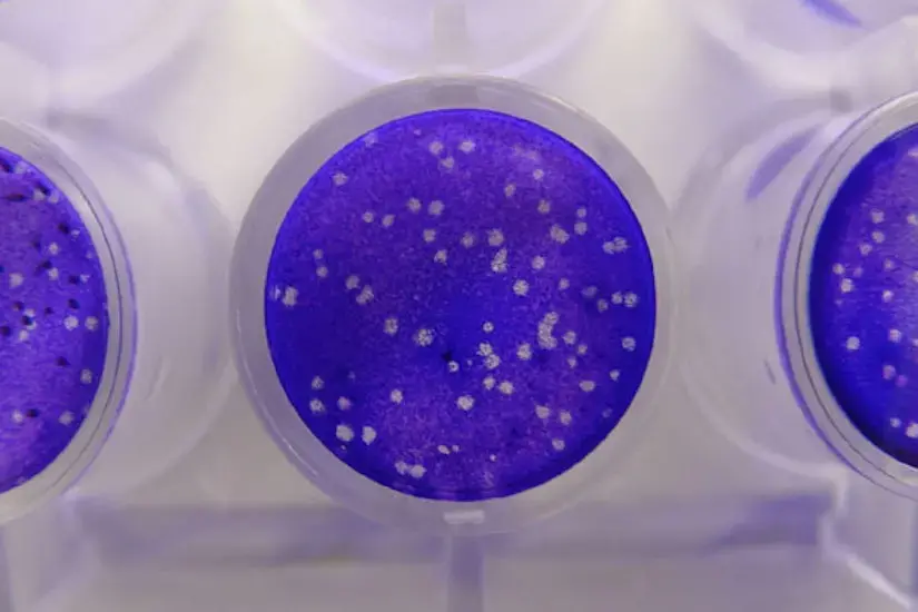 plaque assay