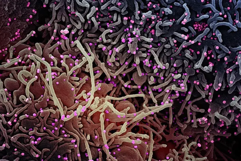cell being infected by COVID-19 particles