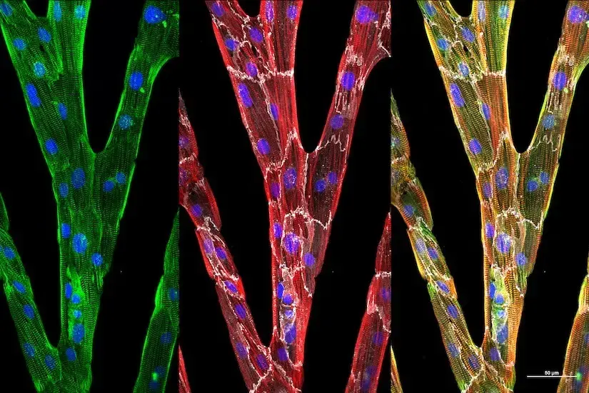 individual heart cells