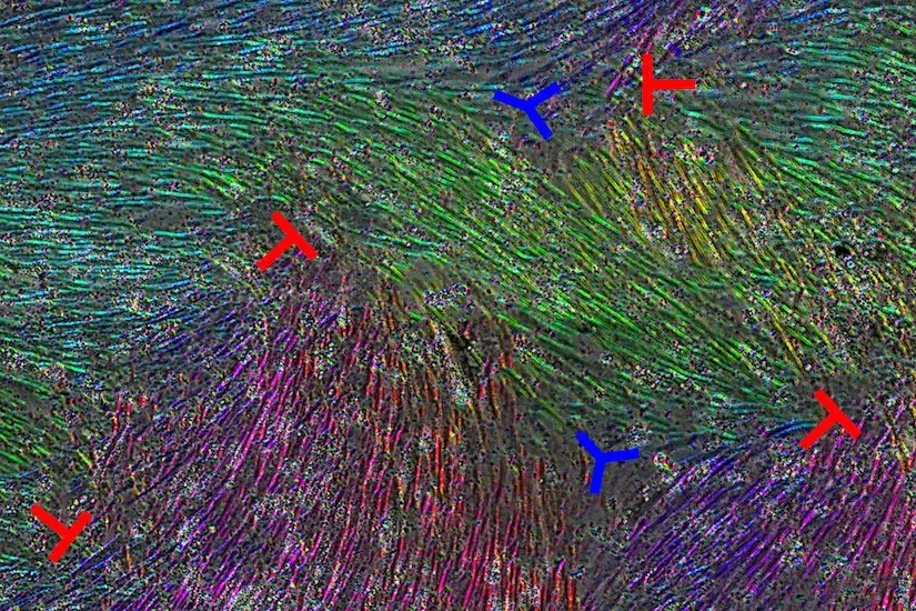 Mesothelial cells