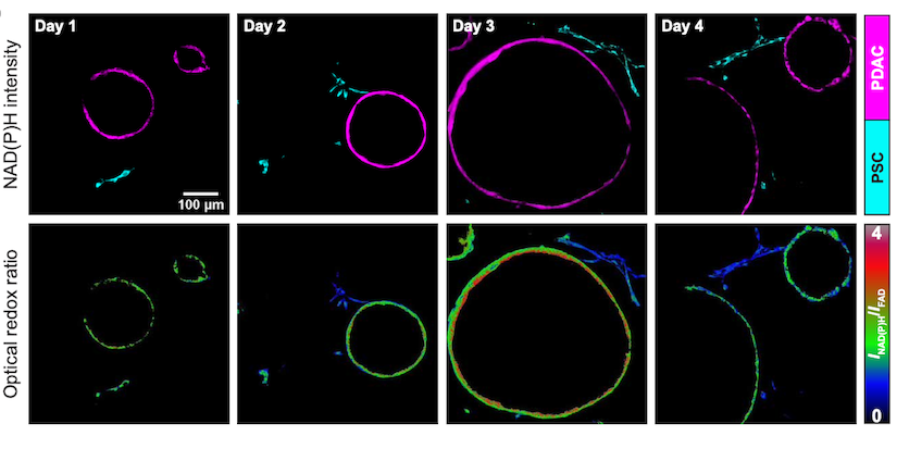 pancreatic cancer cells