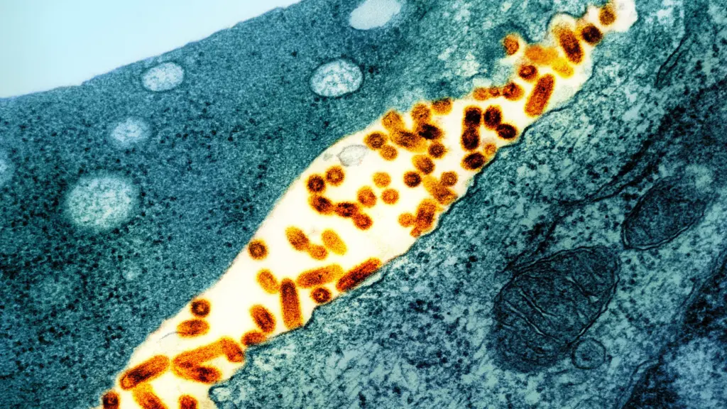 transmission electron micrograph of the vesicular stomatitis virus