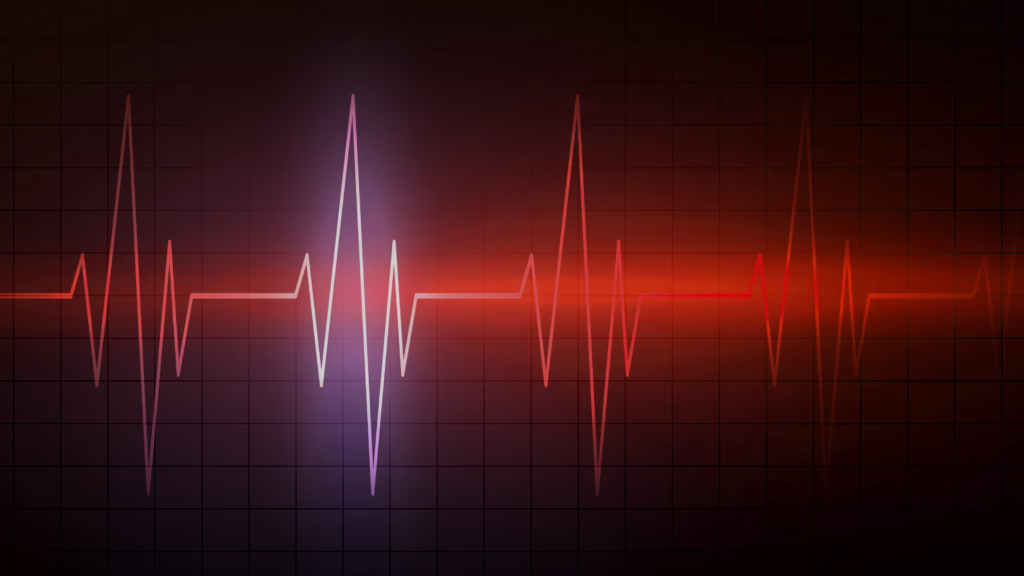 Stock image of an electrocardiogram readout