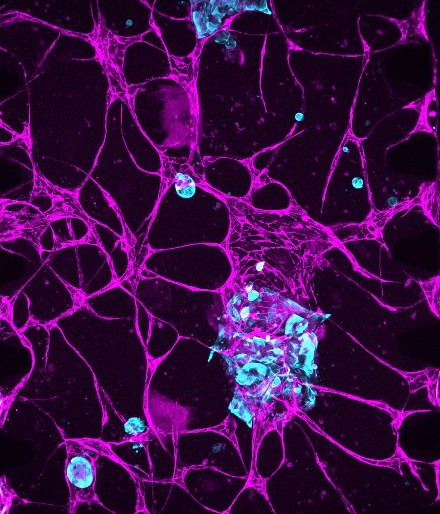 Microscope image of blood vessels (magenta) surrounding organoid models (cyan).