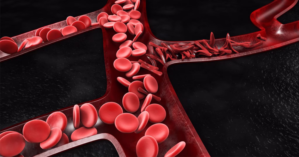 supercomputer simulations of blood flow